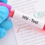 HIV / Aids Test Centers